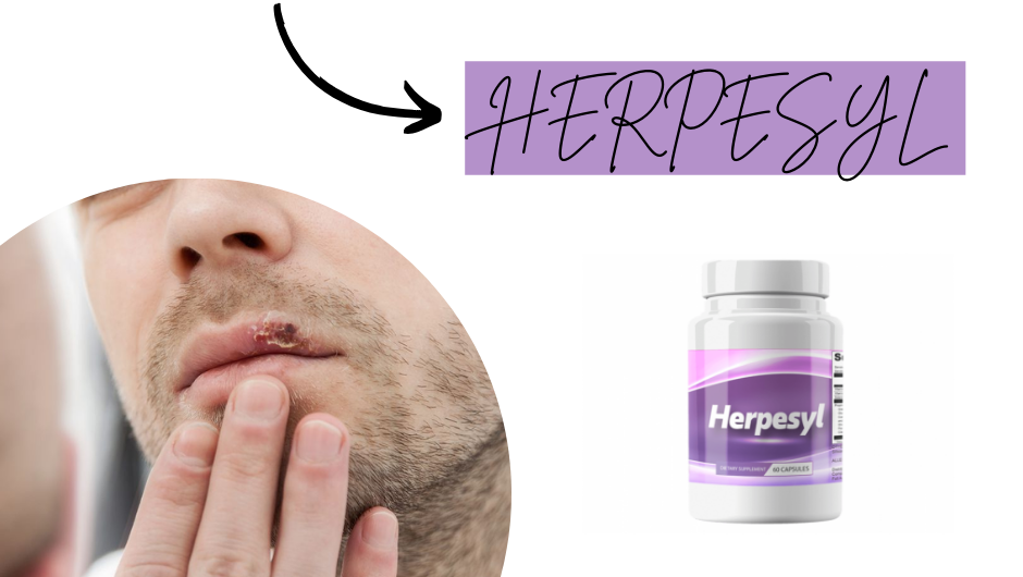 Best Supplement for Herpes | HSV 1 & HSV 2 Treatment