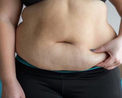 m4lmcra_weight-gain-causes-in-women_625x300_24_March_23